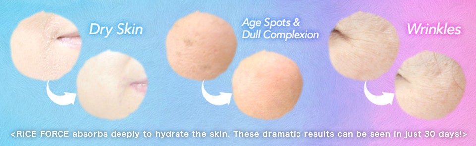 < RICE FORCE absorbs deeply to hydrate the skin. These dramatic results can be seen in just 30 days! >